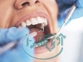 خدمات دندانپزشکی تحت پوشش بیمه سلامت افزایش یافت