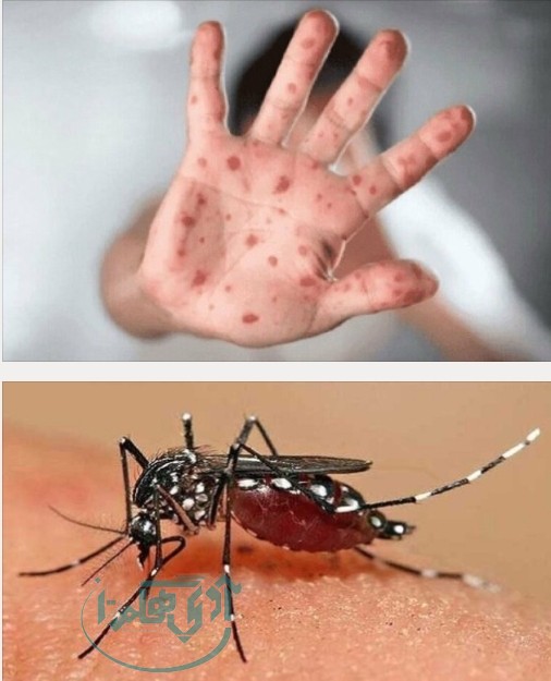 موردی از ابتلا به تب دنگی و آبله میمونی در استان مشاهده نشده