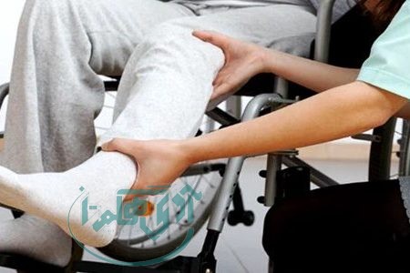 سارکوپنی یا تحلیل عضلات را جدی بگیرید