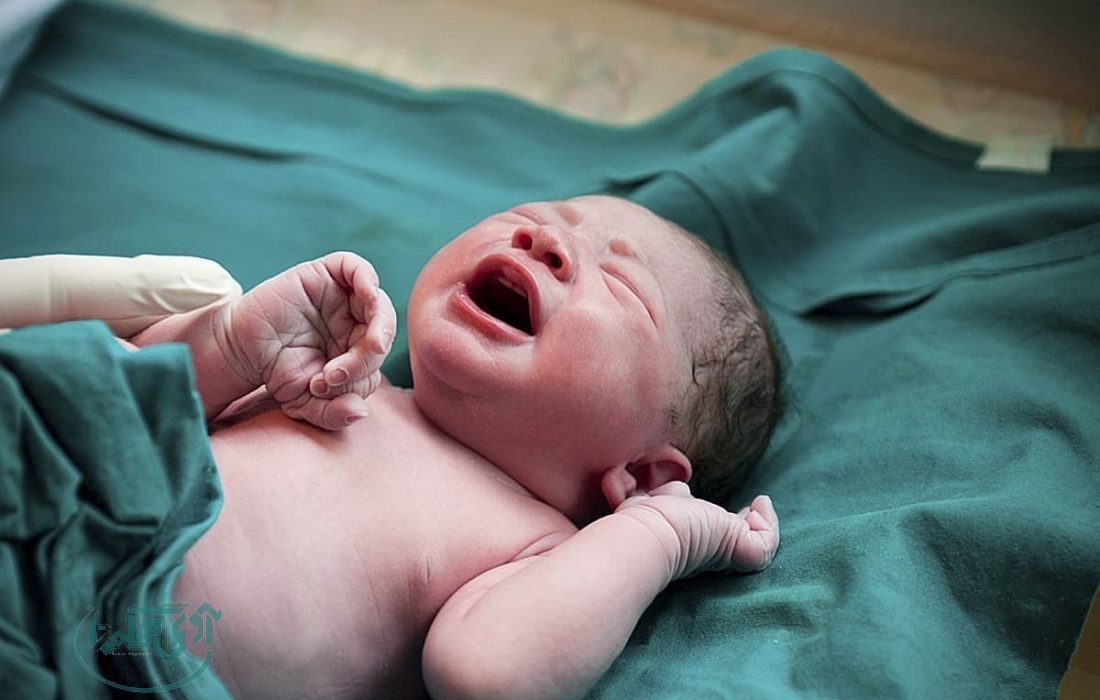 ممنوعیت سزارین تقویمی در تاریخ ۰۴/۰۴/۰۴ در همدان