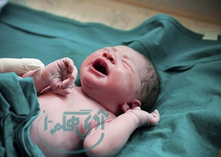 ممنوعیت سزارین تقویمی در تاریخ ۰۴/۰۴/۰۴ در همدان